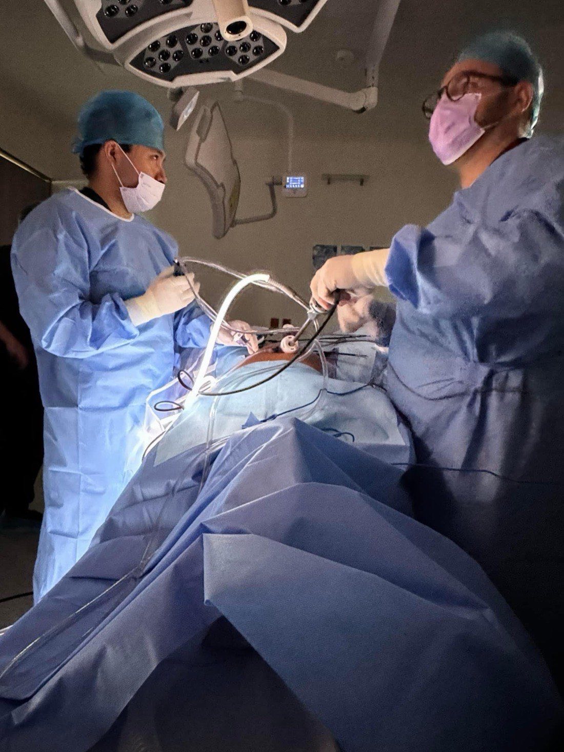 Equipo quirúrgico durante una cirugía laparoscópica
